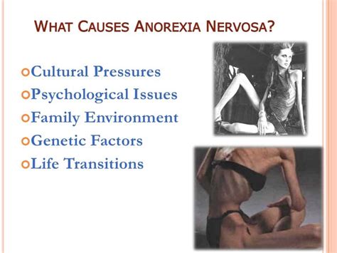 what causes anorexia nervosa.